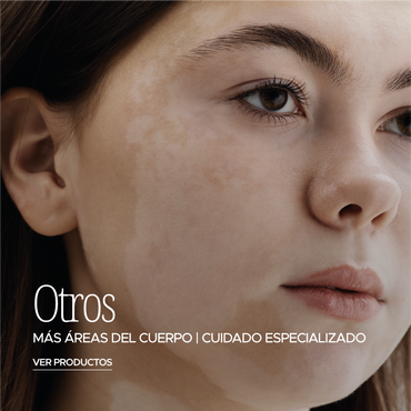 MAS OPCIONES